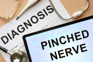 Do Pinched Nerves Go Away on Their Own