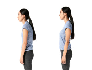 Can a Chiropractor Help With Posture