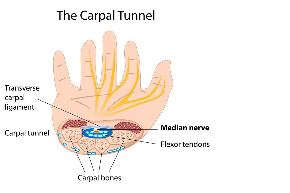 Nonsurgical Treatment Options for Carpal Tunnel Syndrome