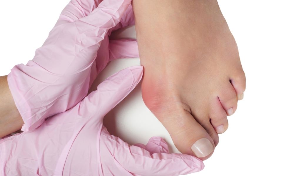 Chiropractic Care for Swollen Toes