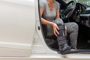 Common-Leg-Injuries-from-Car-Accidents